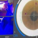 Laser 247 Sign Up Guide: Complete Registration, Login ID Tips & How to Get Started