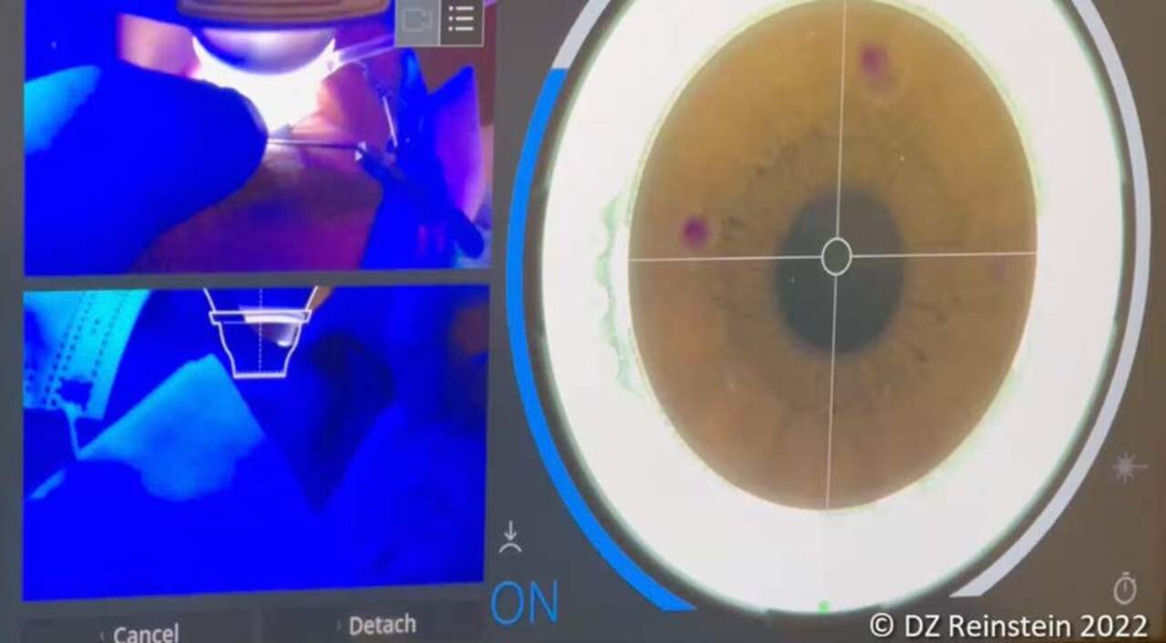 Laser 247 Sign Up Guide: Complete Registration, Login ID Tips & How to Get Started